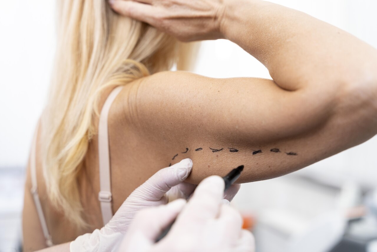 Cirurgia plástica após a perda de peso: como lidar com o excesso de pele!