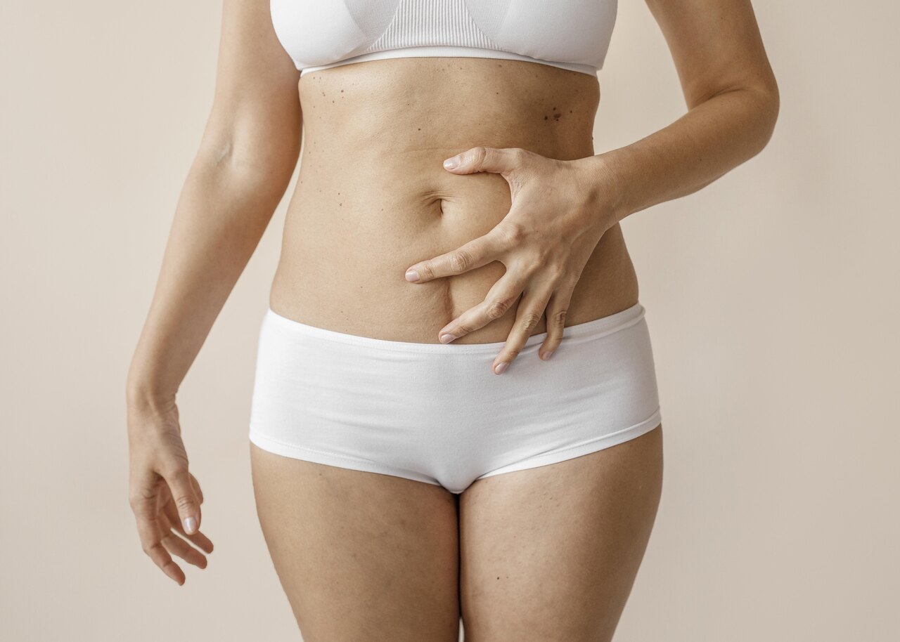 Dr. Reyner Abrantes Stival – Para que serve a órtese de umbigo na abdominoplastia?